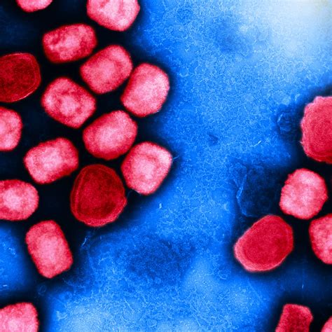 NIH Researchers Charged in Alleged Smuggling of Monkeypox Virus from Republic of Congo